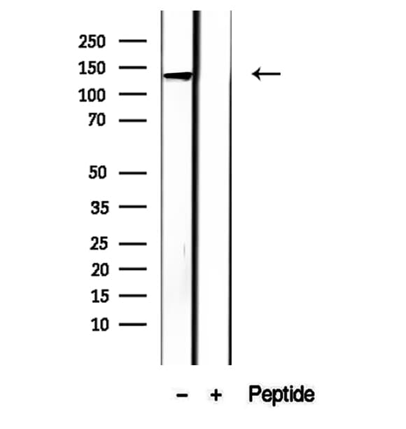 LRPPRC Antibody