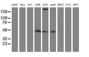 SMS / Spermine Synthase Antibody (clone OTI1G7)