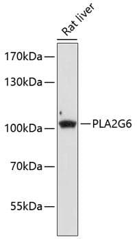 PLA2G6 / IPLA2 Antibody