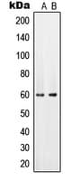 SLC22A6 / OAT1 Antibody (Internal)
