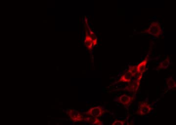 Polyclonal Rabbit anti-Human CBLN1 / Cerebellin 1 Antibody (IF, WB)