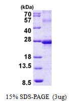 Human EFNA3 / Ephrin A3 Protein (Recombinant His)