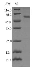 Human RAB23 Protein (Recombinant GST, N-terminus)