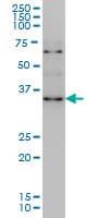 ZIC4 Antibody (clone 3A2)