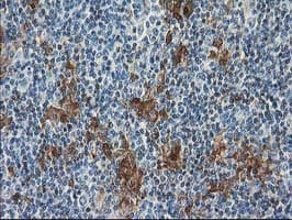SULT1C2 / Sulfotransferase 1C2 Antibody (clone OTI5A11)