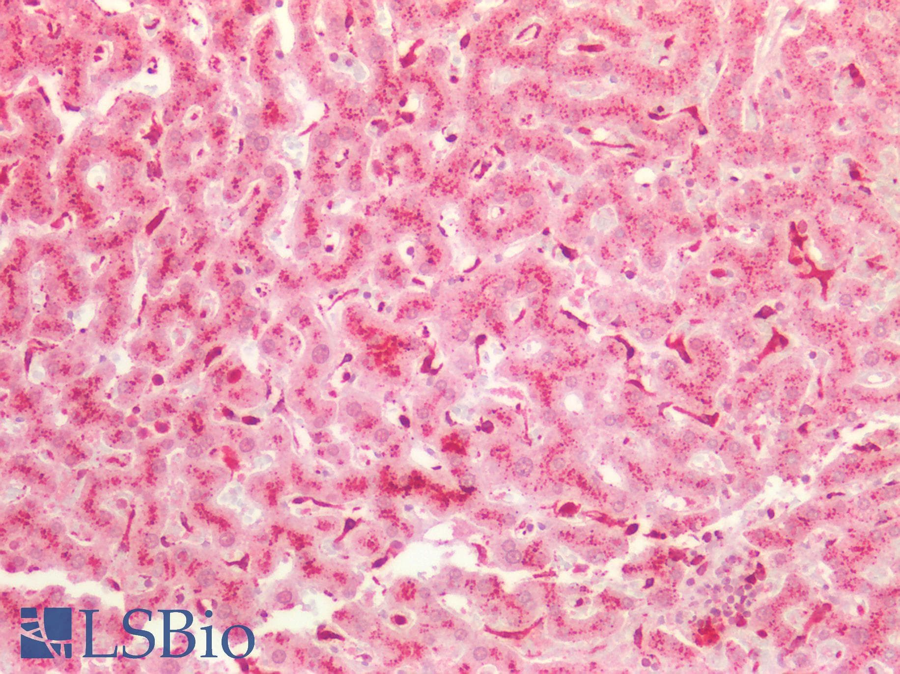 PathPlus™ Polyclonal Rabbit anti-Human AXIN2 / Axin 2 Antibody (IHC, IF, WB)