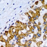 SCP2 / SCPX Antibody