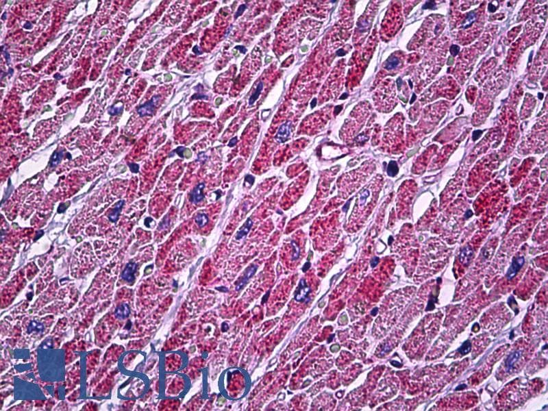 IHC-plus™ ATP5A1 / ATP Synthase Alpha Antibody (aa201-250)