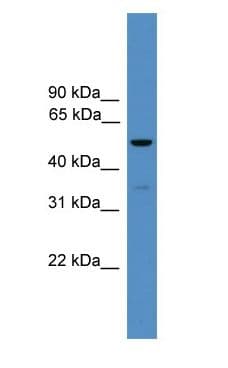 Polyclonal Rabbit anti-Human RORC / ROR Gamma Antibody (N-Terminus, WB)