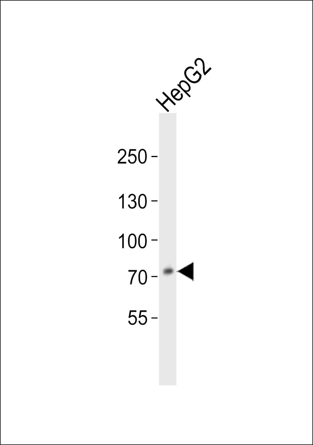 PCSK9 Antibody (aa479-508)