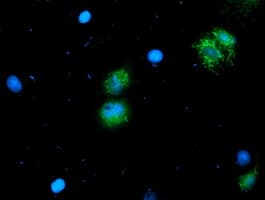 ALS2CR1 / NIF3L1 Antibody (clone OTI3E1)