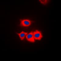 CSNK1G1 / CKI-Gamma 1 Antibody (N-Terminus)