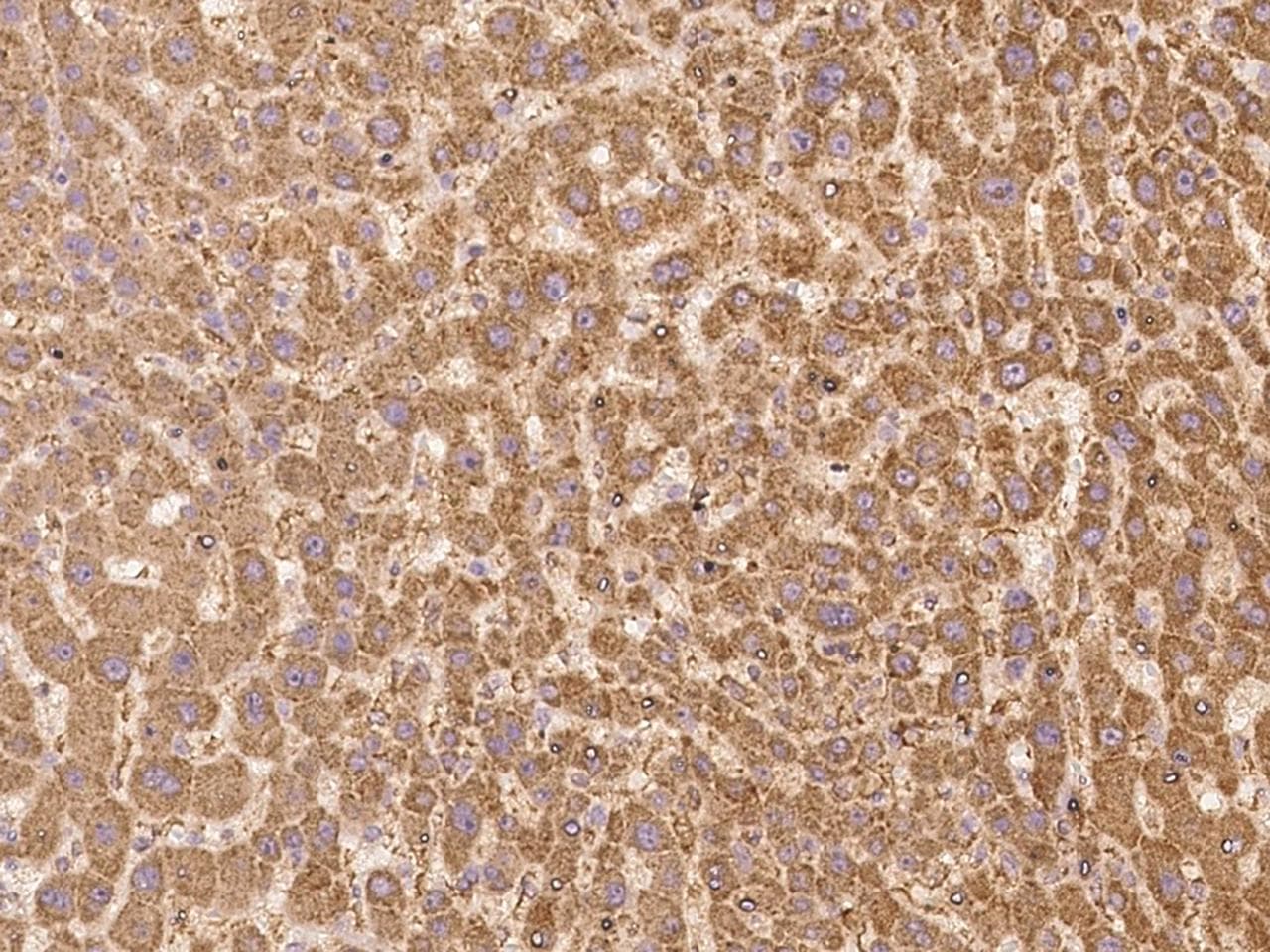 Polyclonal Rabbit anti-Human LMBRD2 Antibody (IHC, IF)