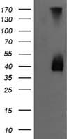 Monoclonal Mouse anti-Human MAP2K3 / MEK3 / MKK3 Antibody (clone OTI6C6, IHC, IF, WB)
