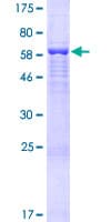 Human FAM46D Protein (Recombinant GST)