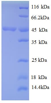Sporosarcina ureae pdh Protein (Recombinant His)