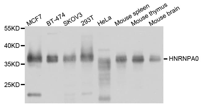 Polyclonal Rabbit anti-Human HnRNP A0 Antibody (IHC, WB)