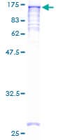 Human NAT10 Protein (Recombinant GST)