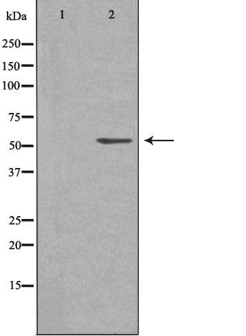 Polyclonal Rabbit anti-Human SHPK / CARKL Antibody (IHC, IF, WB)