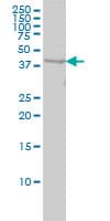 IHC-plus™ Monoclonal Mouse anti-Human WDR77 / MEP50 Antibody (clone 3F10, IHC, WB)