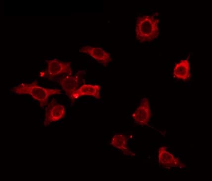CD6 Antibody