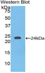 CD144 / CDH5 / VE Cadherin Antibody (aa251-426)