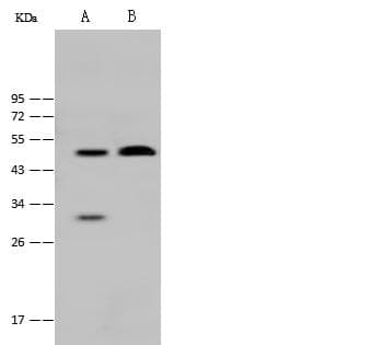 Polyclonal Rabbit anti-Human MBD2 Antibody (Preservative Free, WB)