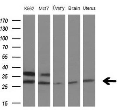 MYL4 Antibody (aa2-197, clone OTI1H6)