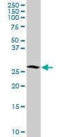 MAGE12 / MAGEA12 Antibody (clone 3A10)