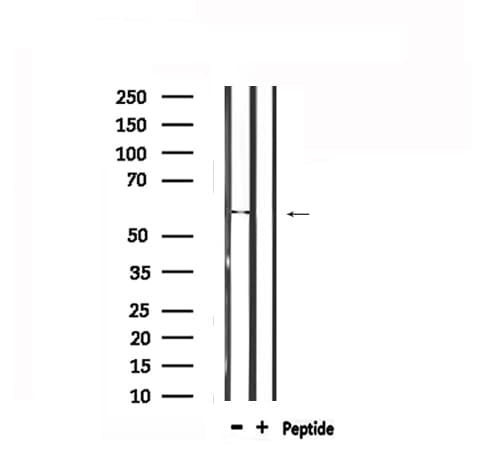 TPH1 / Tryptophan Hydroxylase Antibody