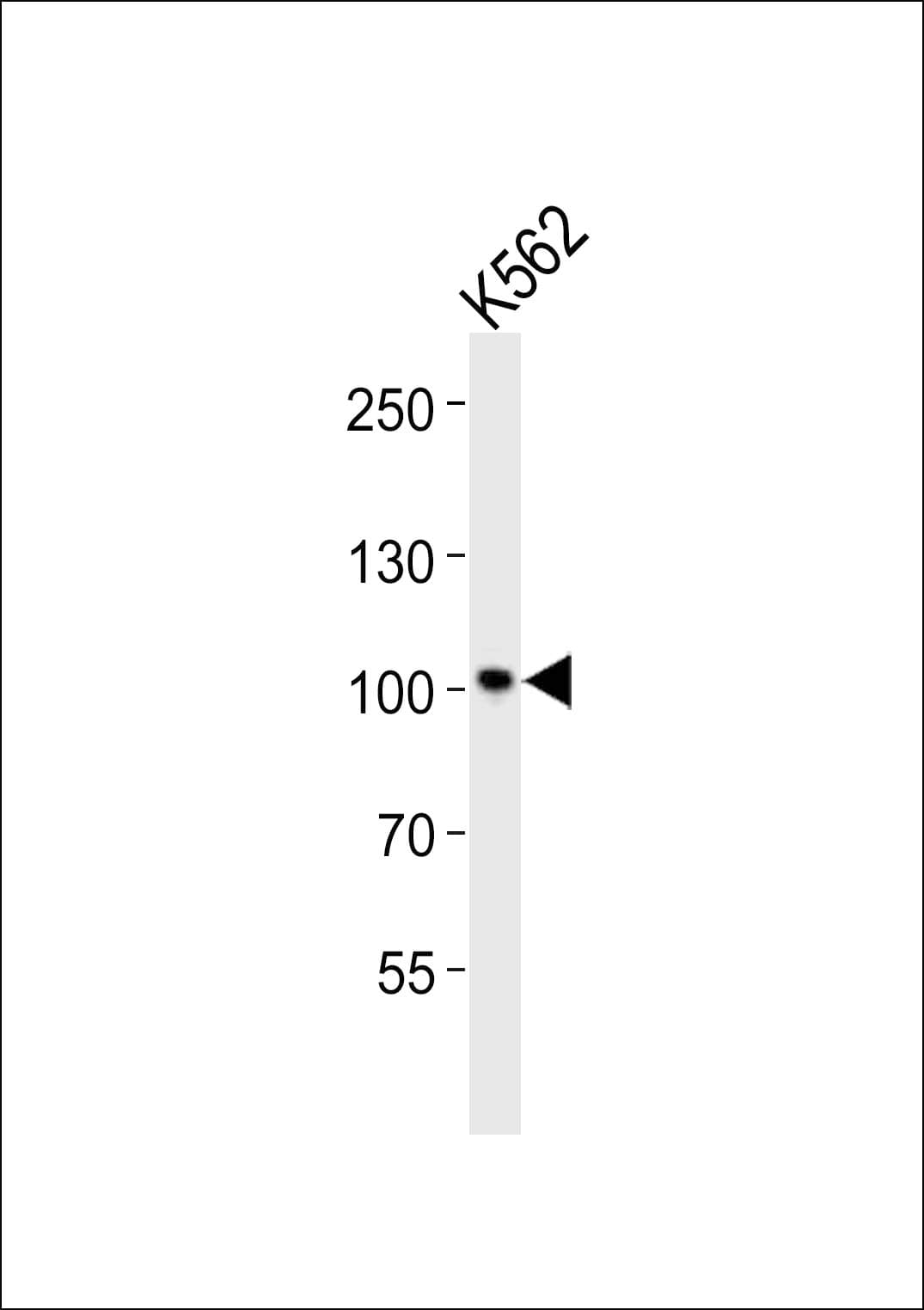 STAT5A Antibody (aa730-765)
