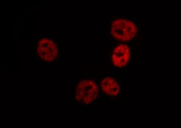 Polyclonal Rabbit anti-Human FANCD2 Antibody (phospho-Ser222, IHC, IF, WB)