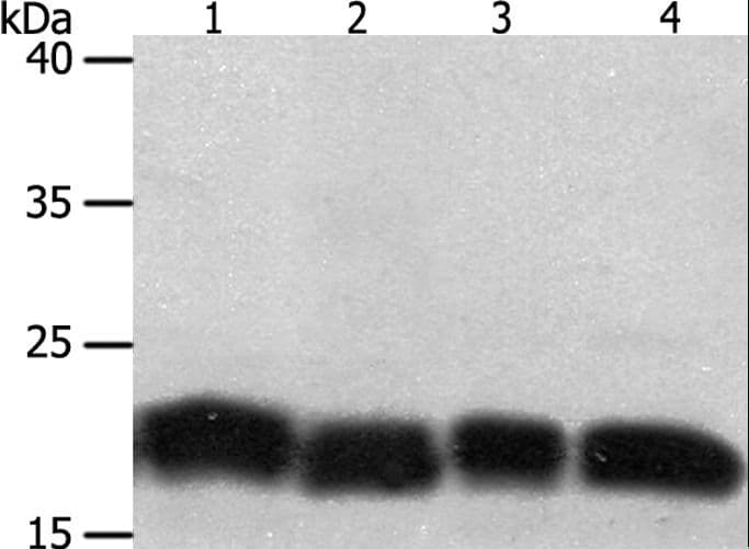 PDCD6 / ALG-2 Antibody