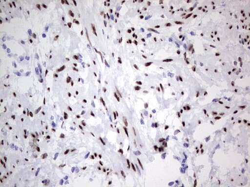 Monoclonal Mouse anti-Human PR / Progesterone Receptor Antibody (clone OTI4C12, aa1-298, IHC, WB)