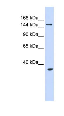 UBE3B Antibody (aa720-769)