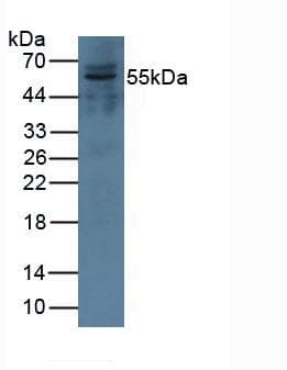 CFI / Complement Factor I Antibody (aa28-243, APC)