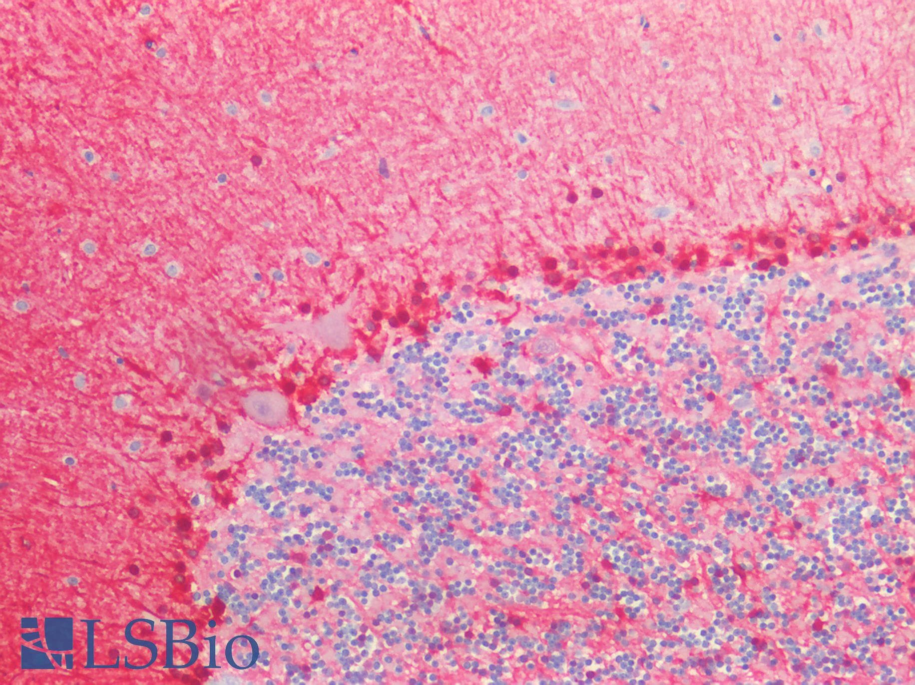 PathPlus™ ALDH1A1 / ALDH1 Antibody