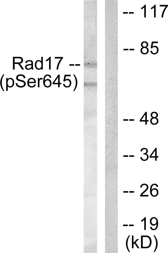 RAD17 Antibody (phospho-Ser645)
