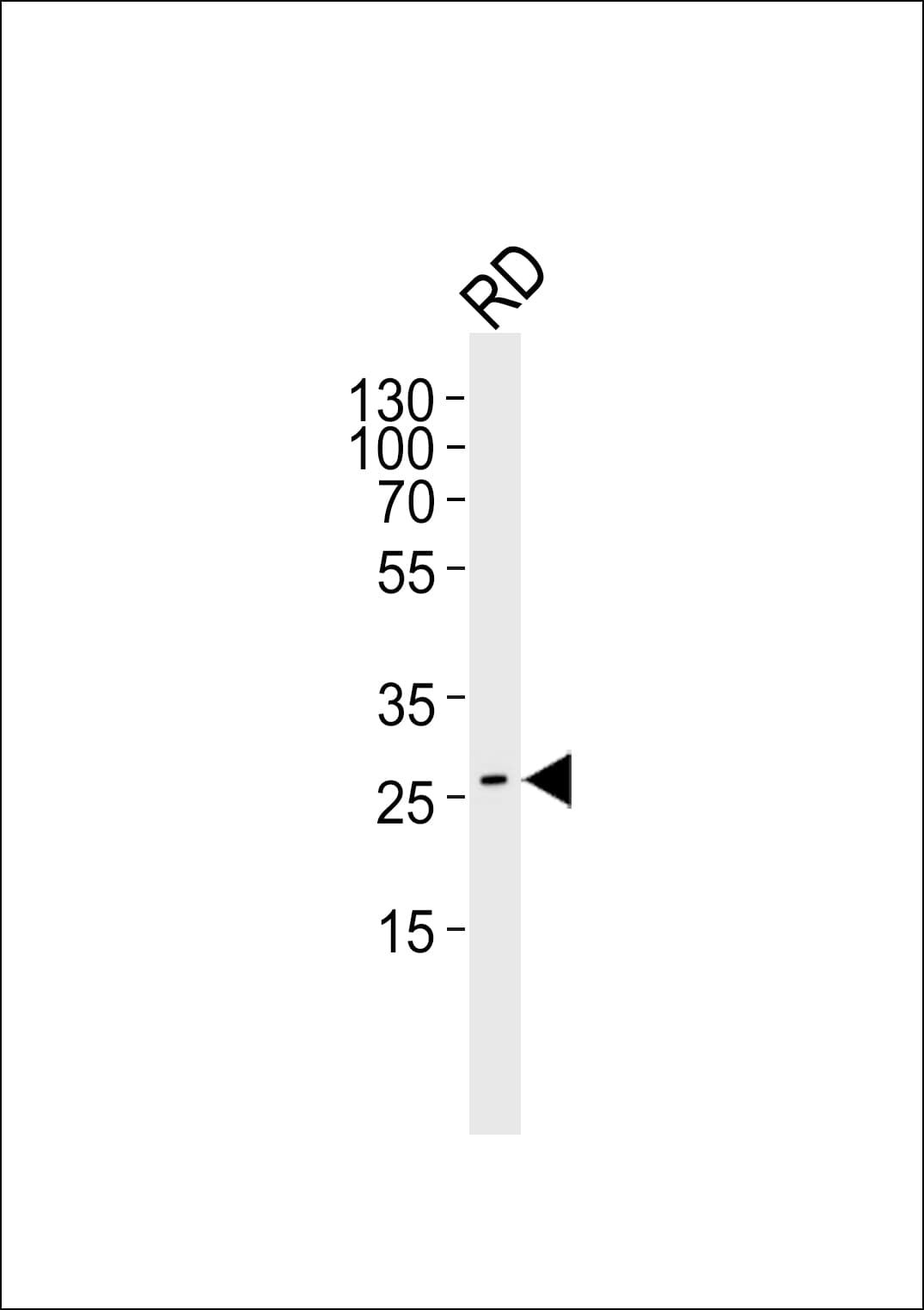 NRG1 / Heregulin / Neuregulin Antibody