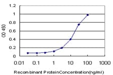 ZIC / ZIC1 Antibody (clone 3F7)