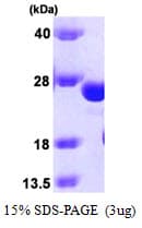 Human GSTK1 Protein (Recombinant)