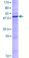 Human MARCH5 Protein (Recombinant GST)