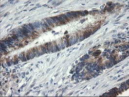 B3GNT2 Antibody (clone OTI3A9)
