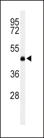 LCAT Antibody (aa285-313)