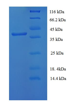 Mouse YBX1 / YB1 Protein (Recombinant His)