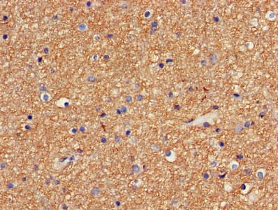 Polyclonal Rabbit anti-Human CR6 / GADD45G Antibody (aa1-159)
