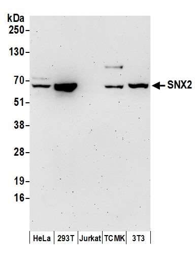 Polyclonal Rabbit anti-Human SNX2 Antibody (aa1-50, WB)