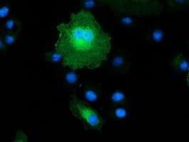 MAPRE2 / EB2 Antibody (clone OTI3C7)