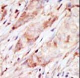 GCK / Glucokinase Antibody (aa403-433)