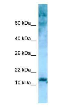 RPL36 / Ribosomal Protein L36 Antibody (aa13-62)